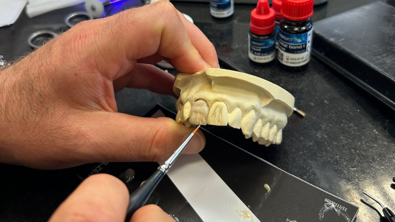 Kulzer Signum Kurs Bjoern Maier Hanau 2024 Zahntechnik Modell
