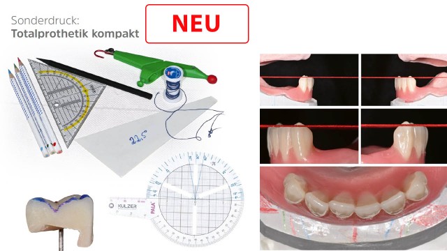 Sonderdruck Totalprothetik kompakt