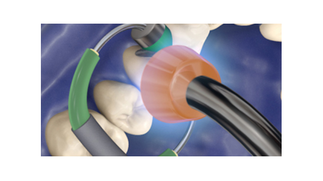 LED-Polymerisationsgeräte