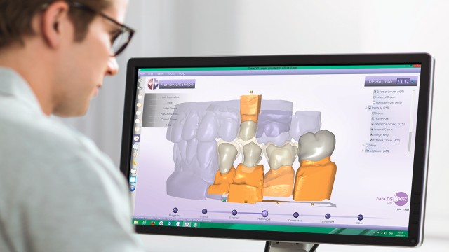 CAD-CAM Lab Processes