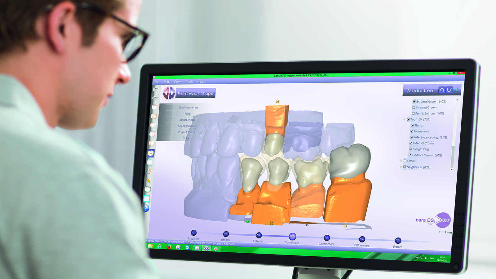 Kulzer CAD/CAM-Lösungen