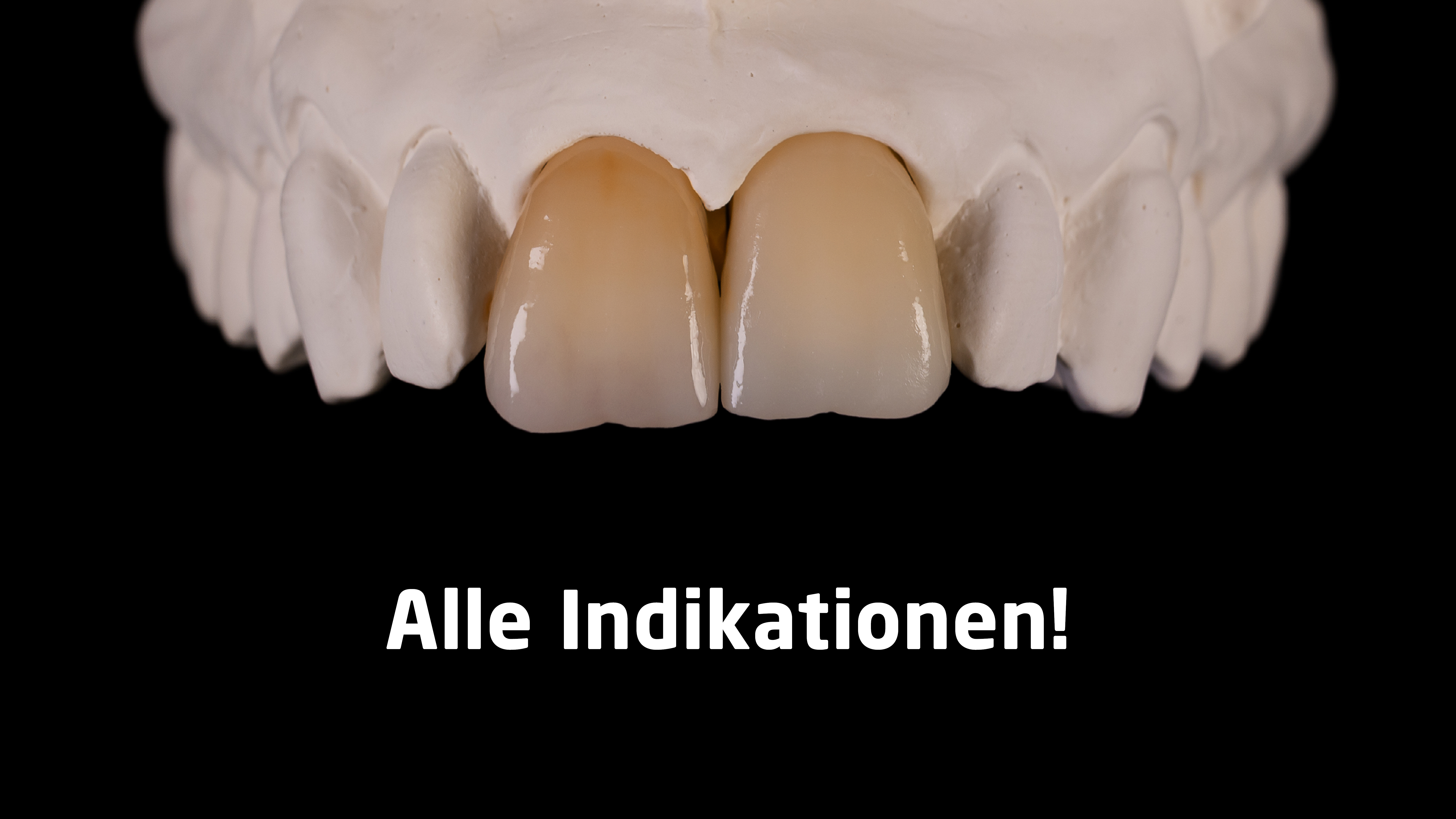 dima mill zirconia alle Indikationen