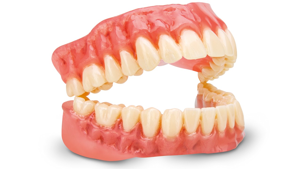 dima® Print Digital Denture